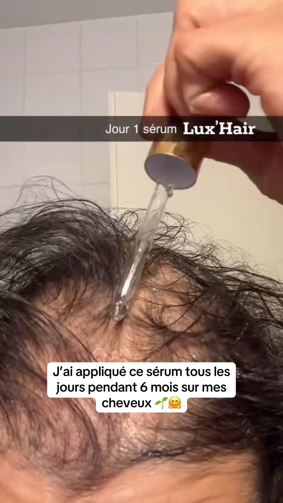 @Lux’Hair Growth FR