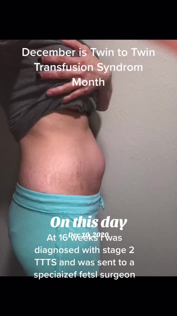@KrisDiy