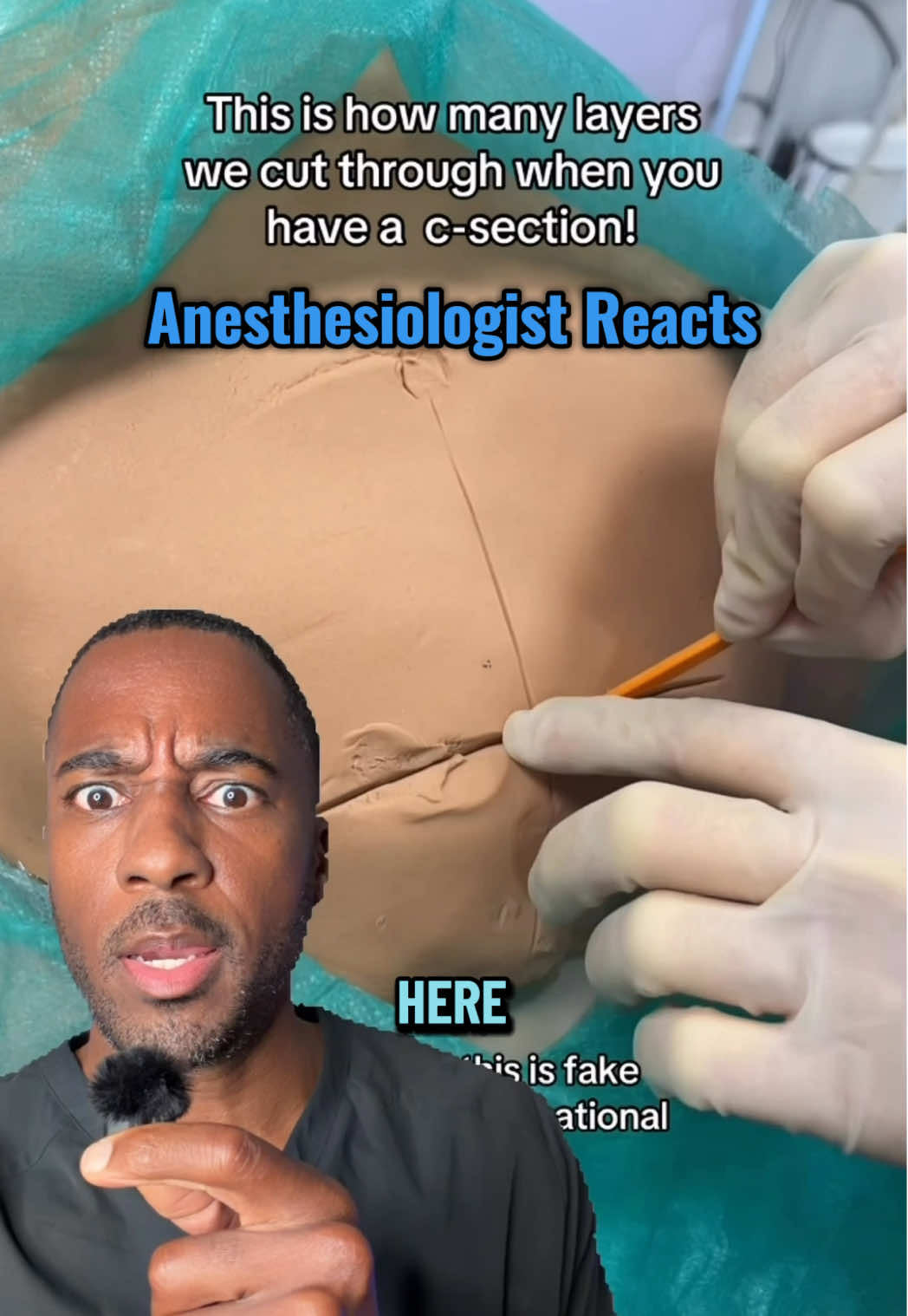 @DocJP3 TikTok Anesthesiologist