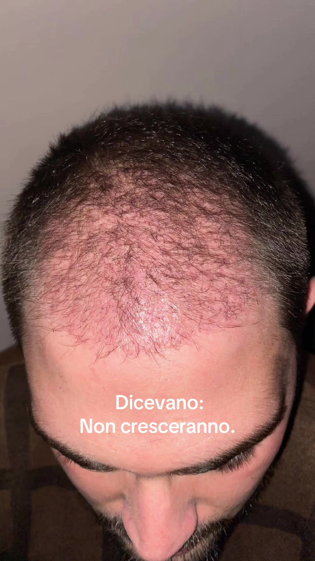 @Luigi Gallipari