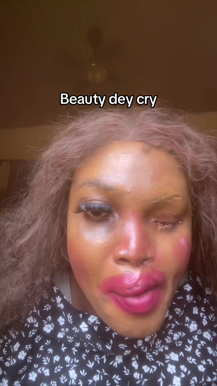 @OMA