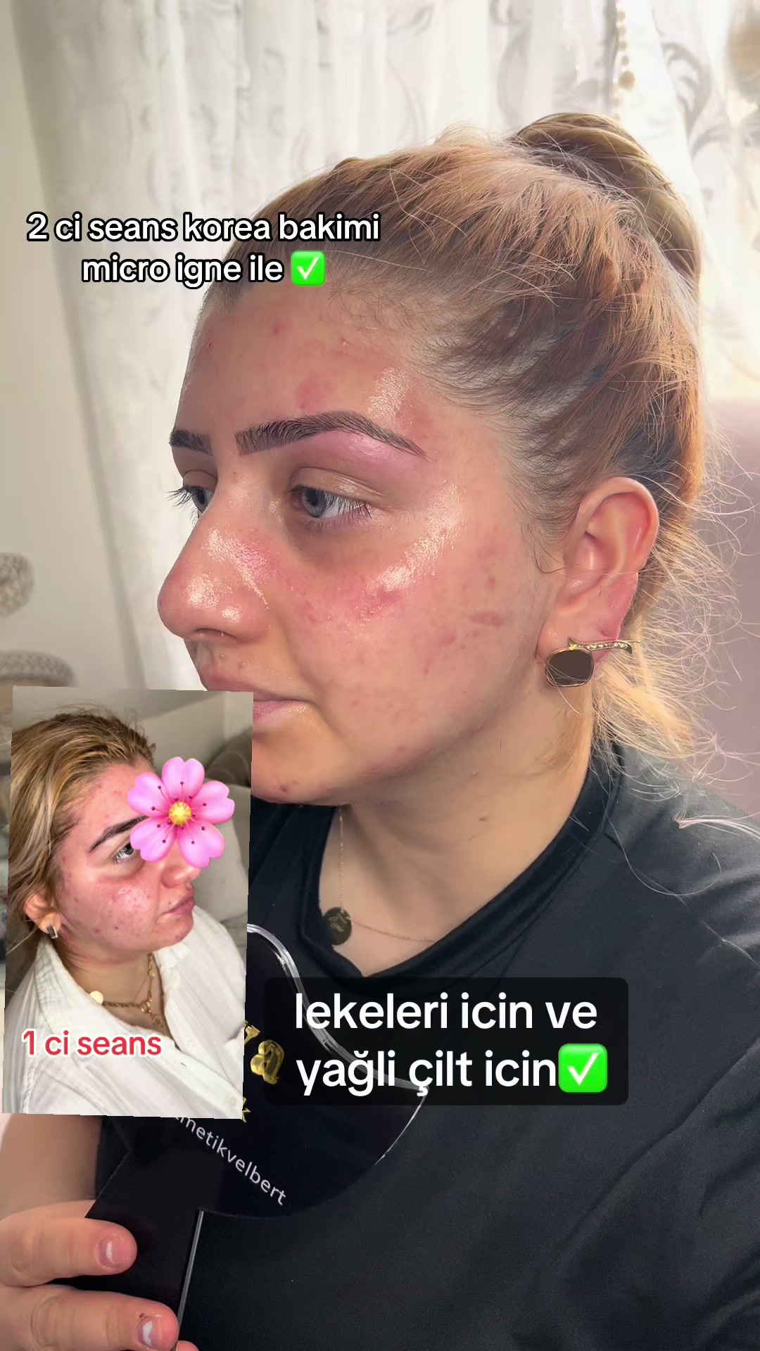 @Melis_klein✅