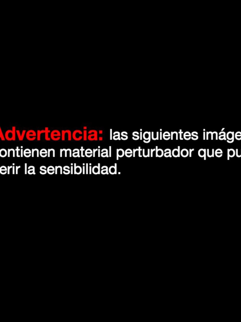 @Guayape TV