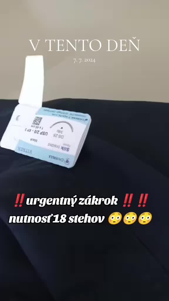 @Anna
