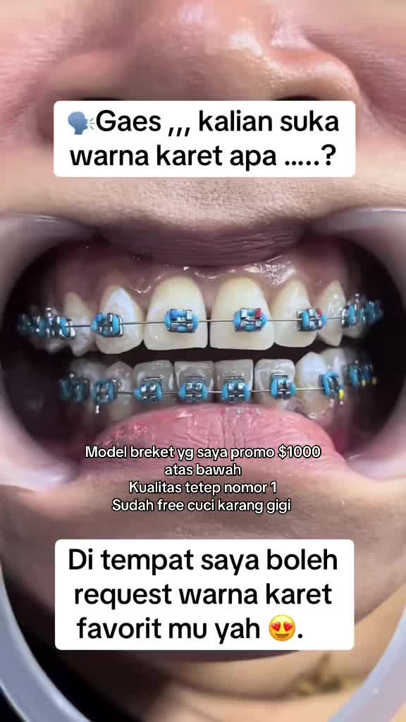 @mbak-Paijem