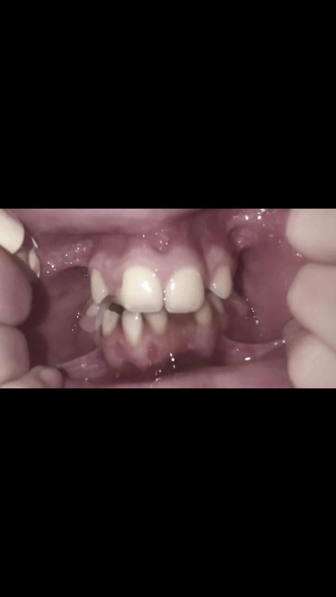 @𝐻𝒶𝓊𝓃𝓉𝑒𝒹