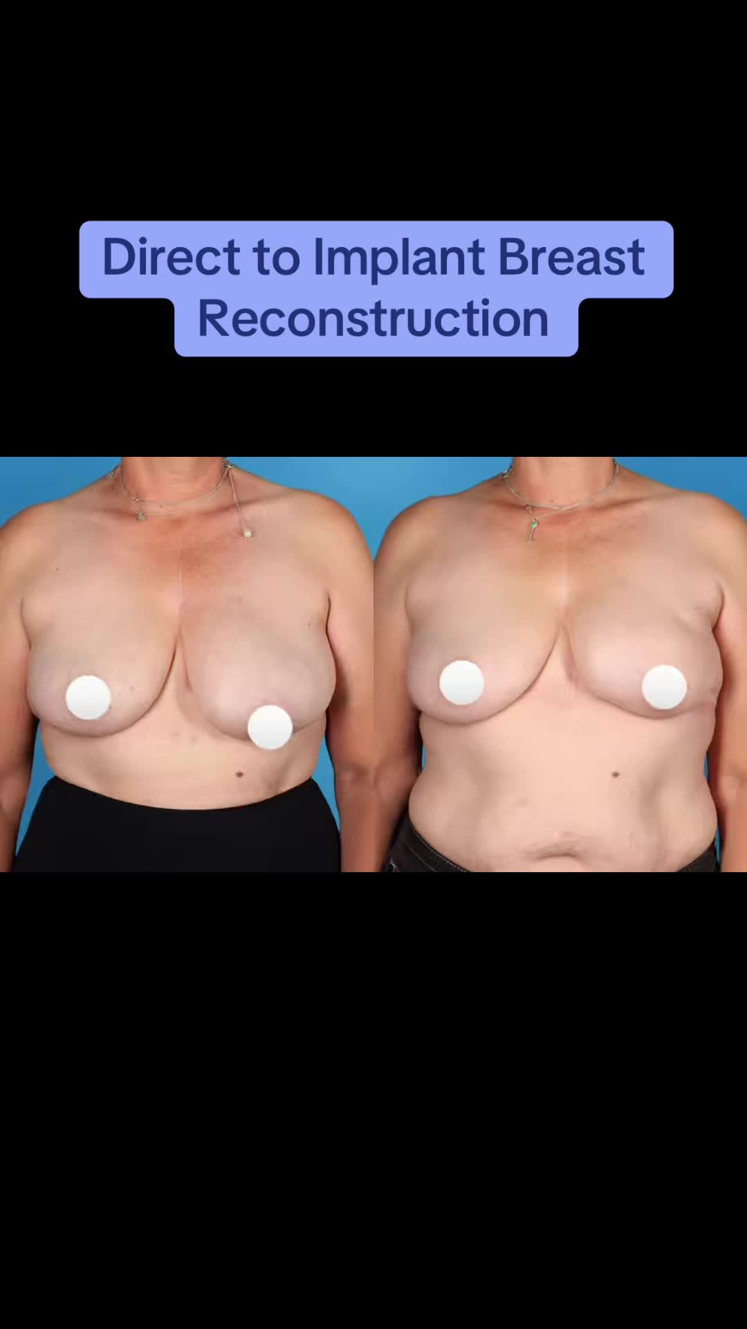 @Kelly Killeen, MD, FACS