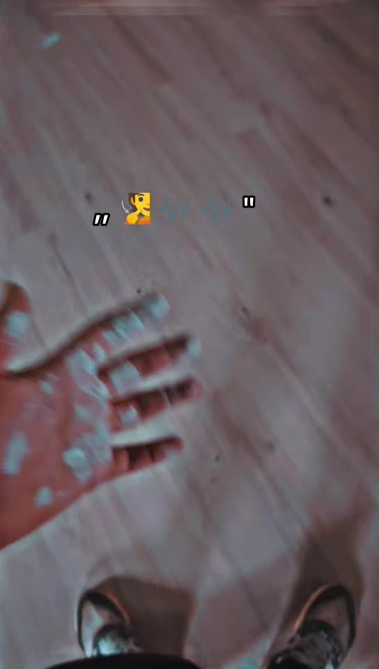 @94 MRM