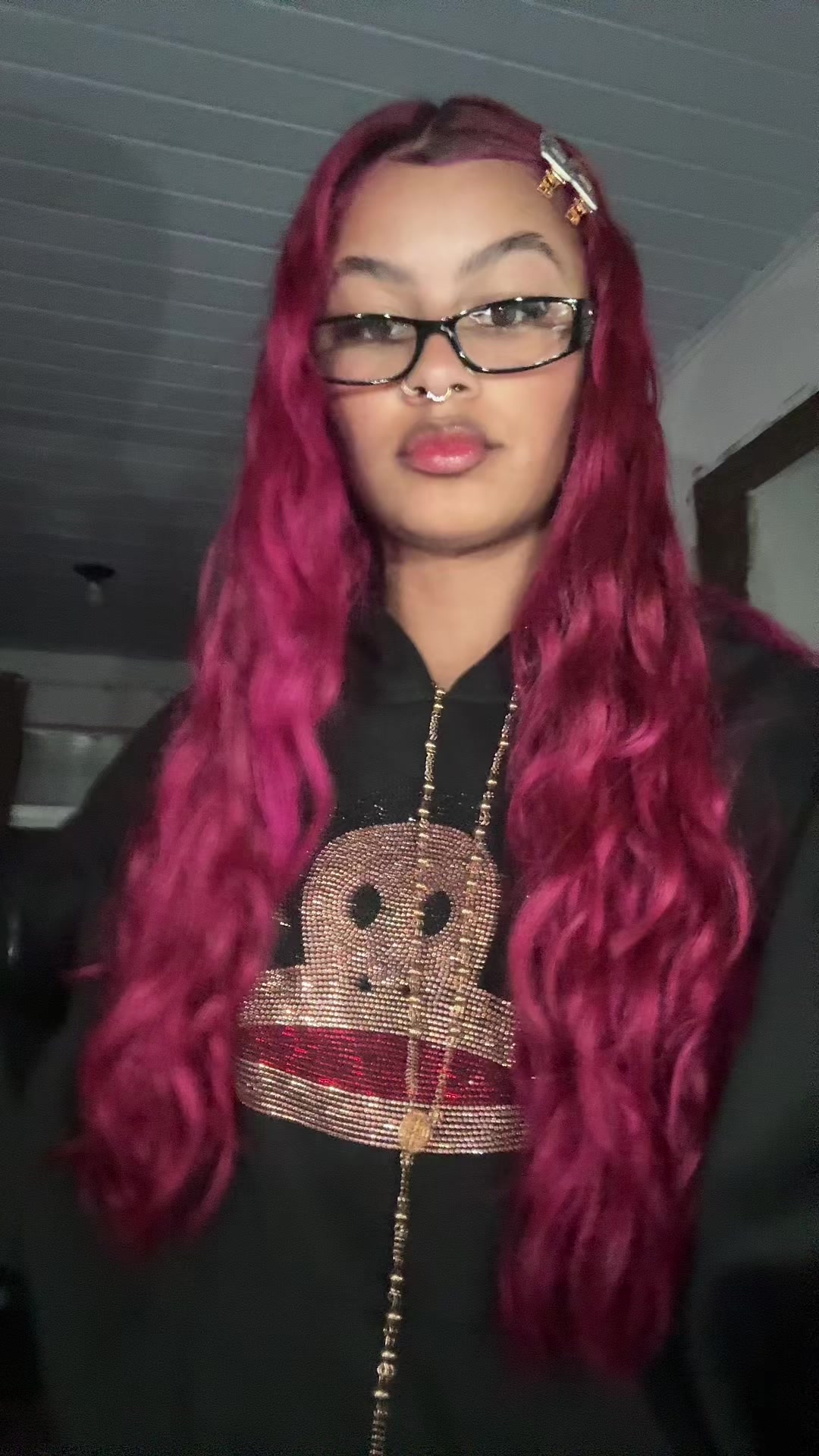 @Ana