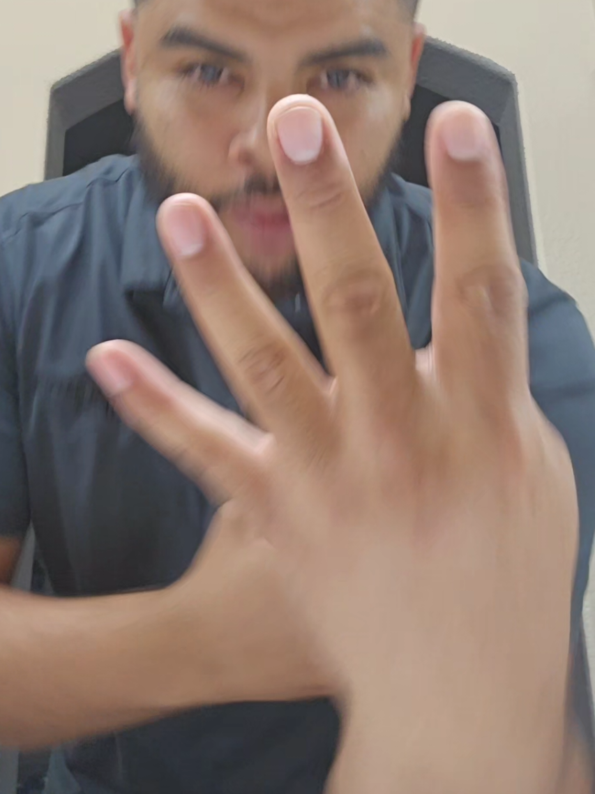 @Experiment 323