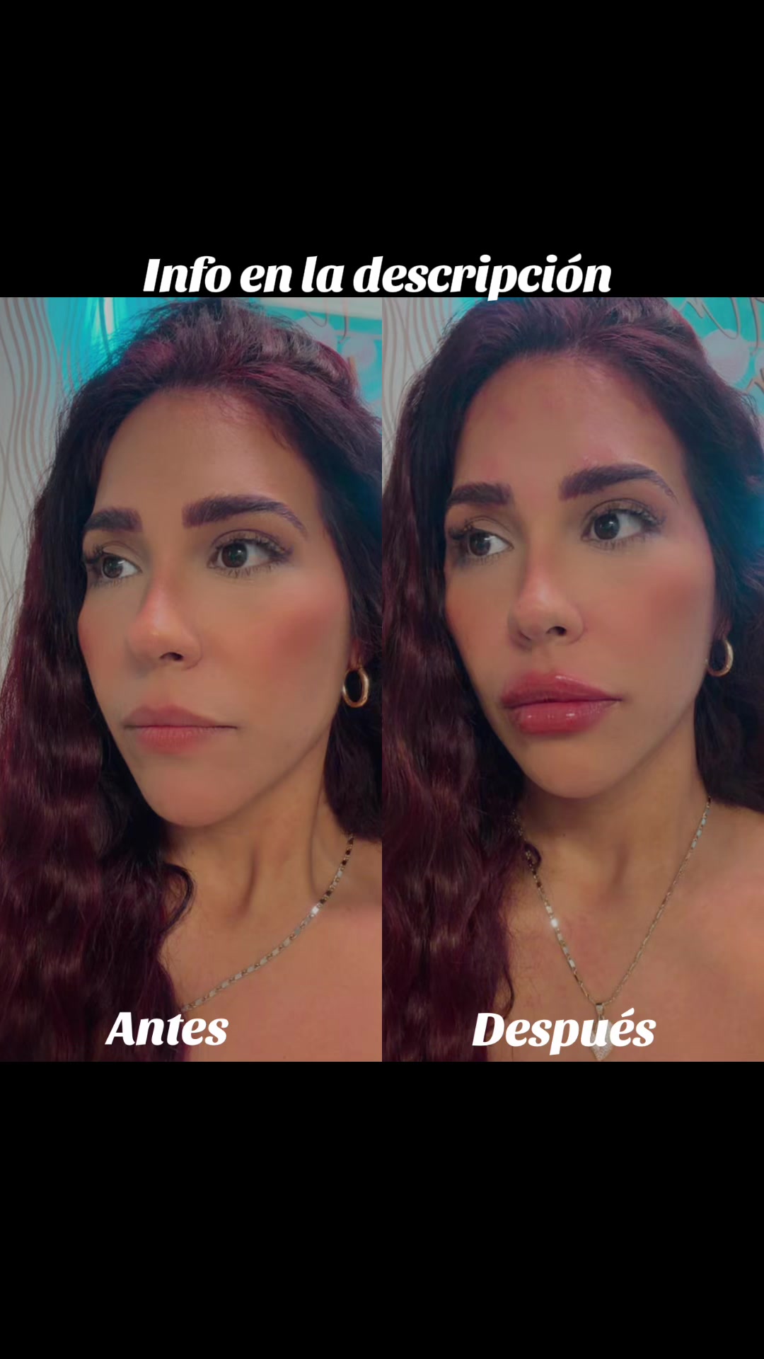 @Gi 🍒