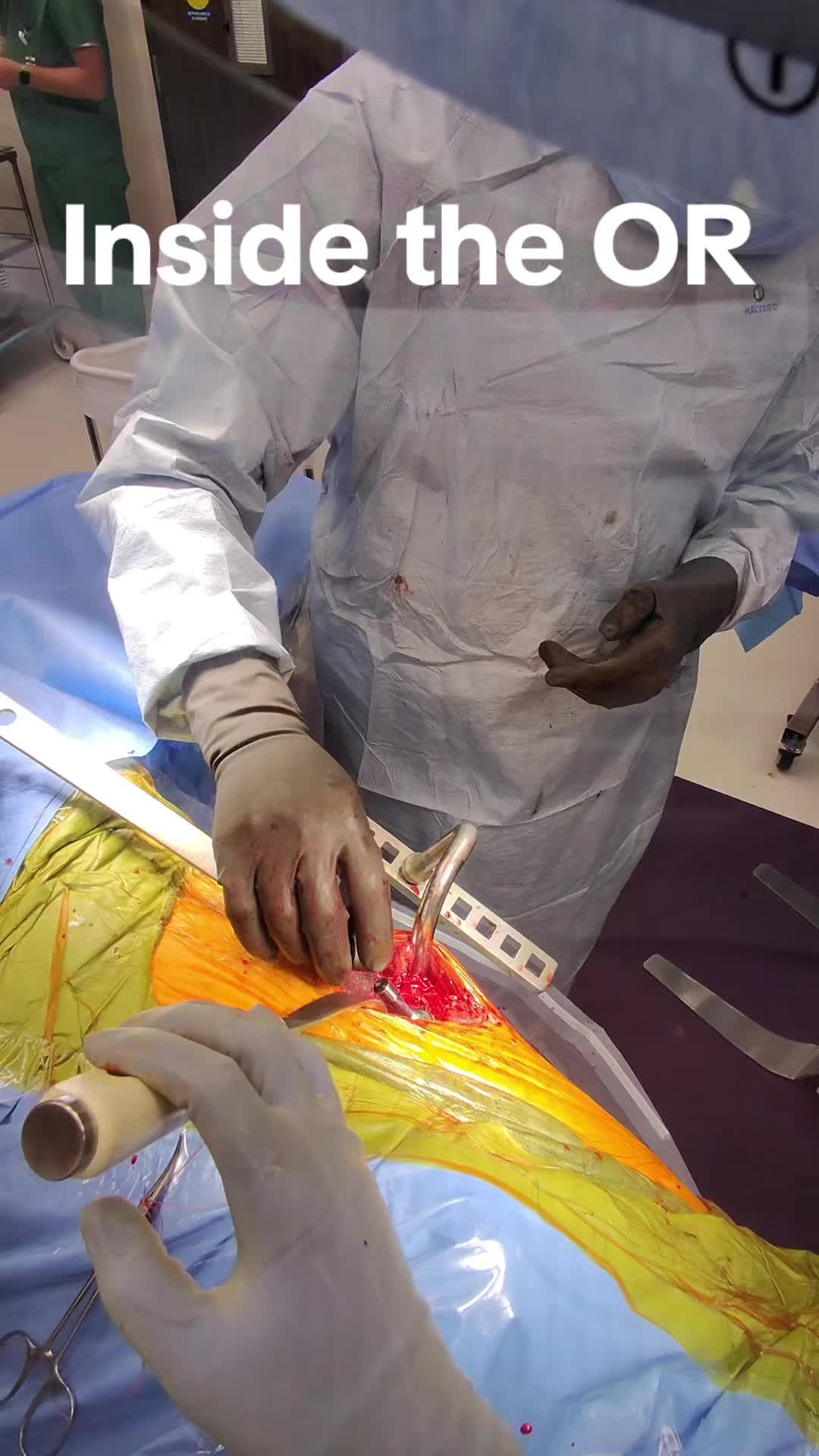 @Ortho POV