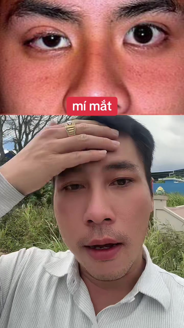 @Tuệ Nhãn ✅