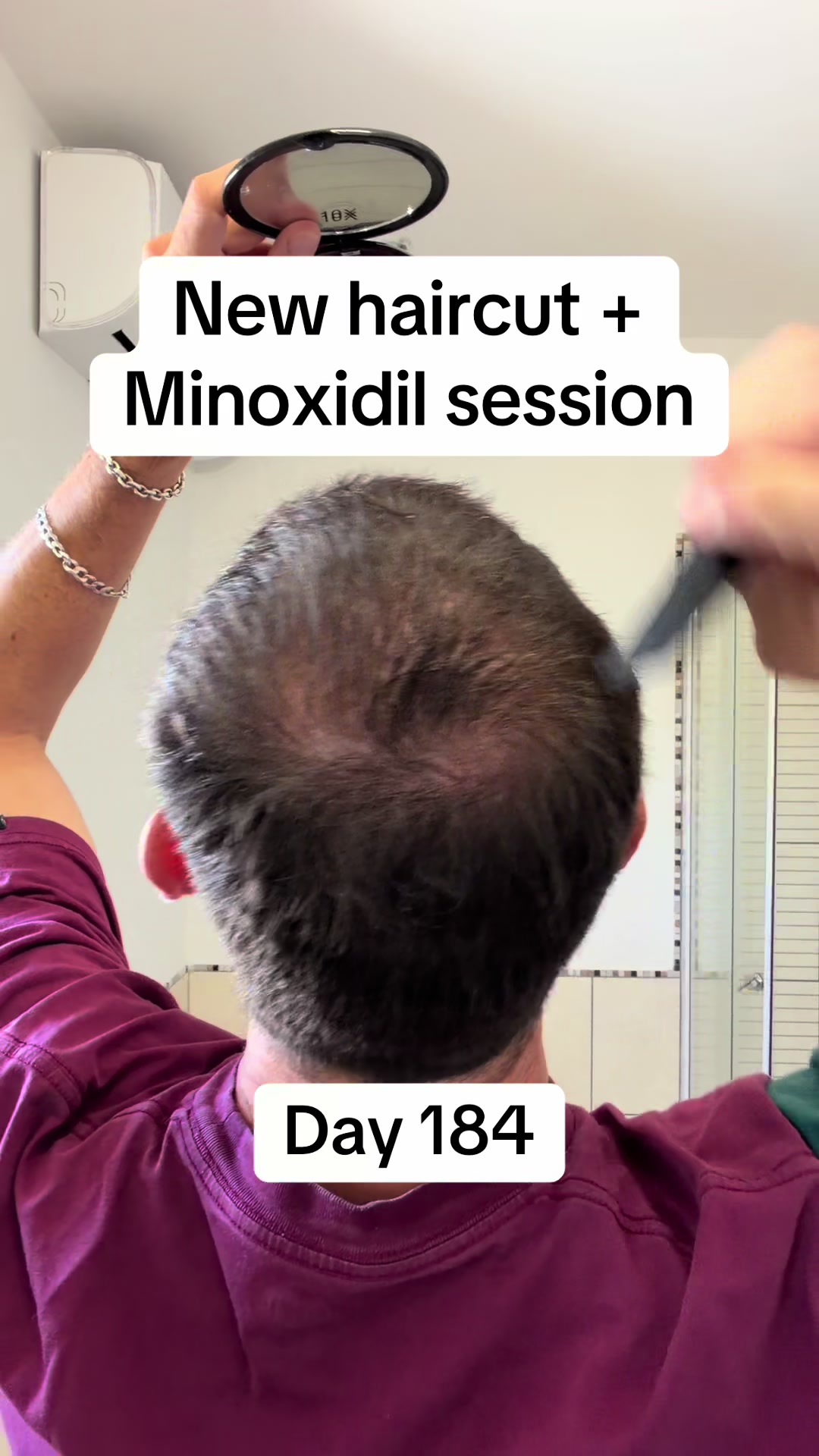 @scalp.hero