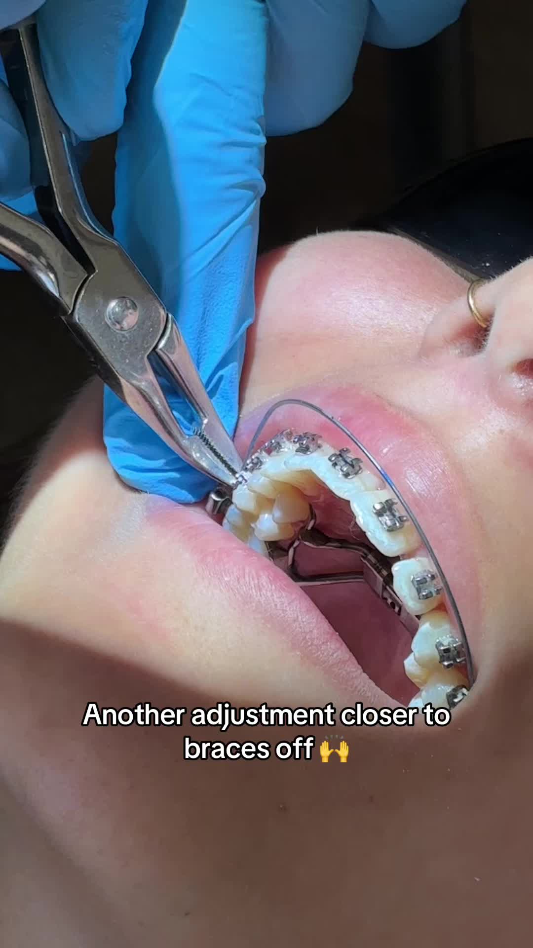 @Woodland Hills Orthodontist