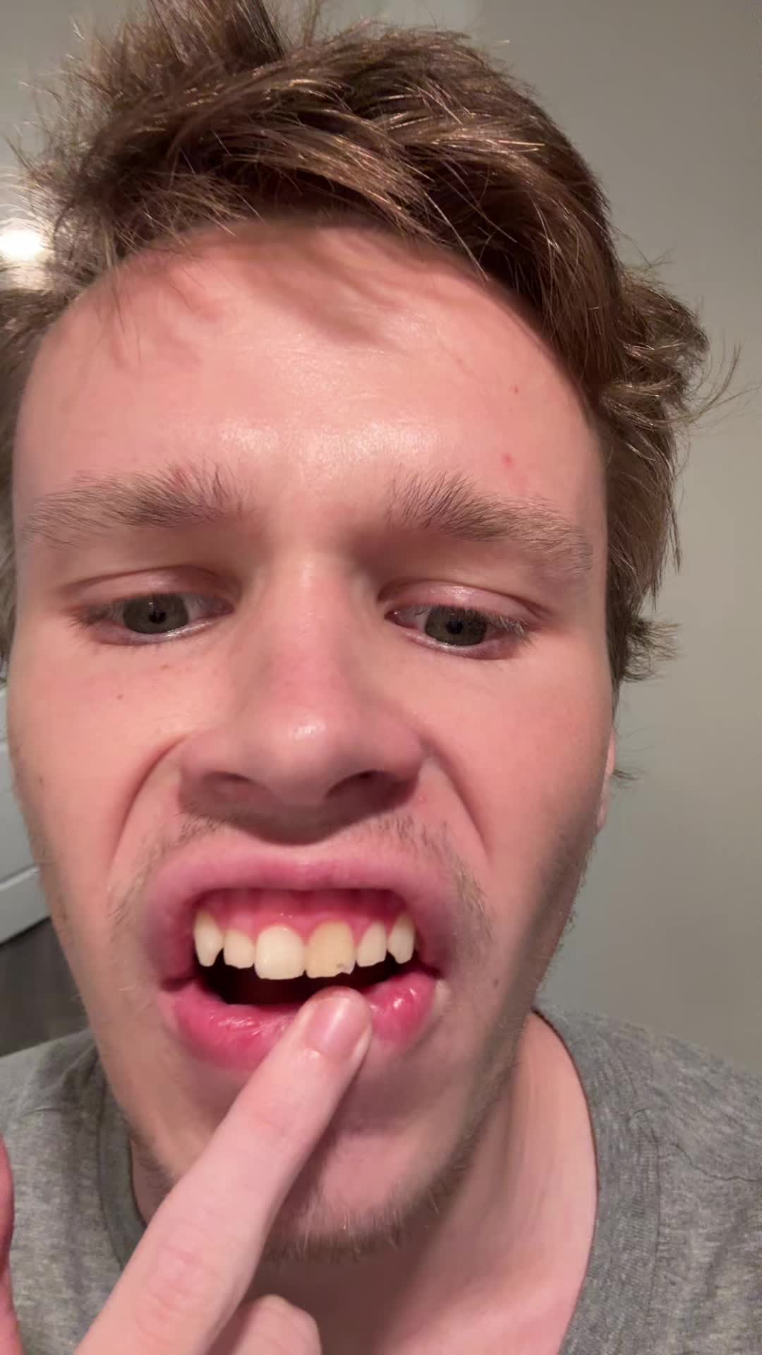 @A1dan