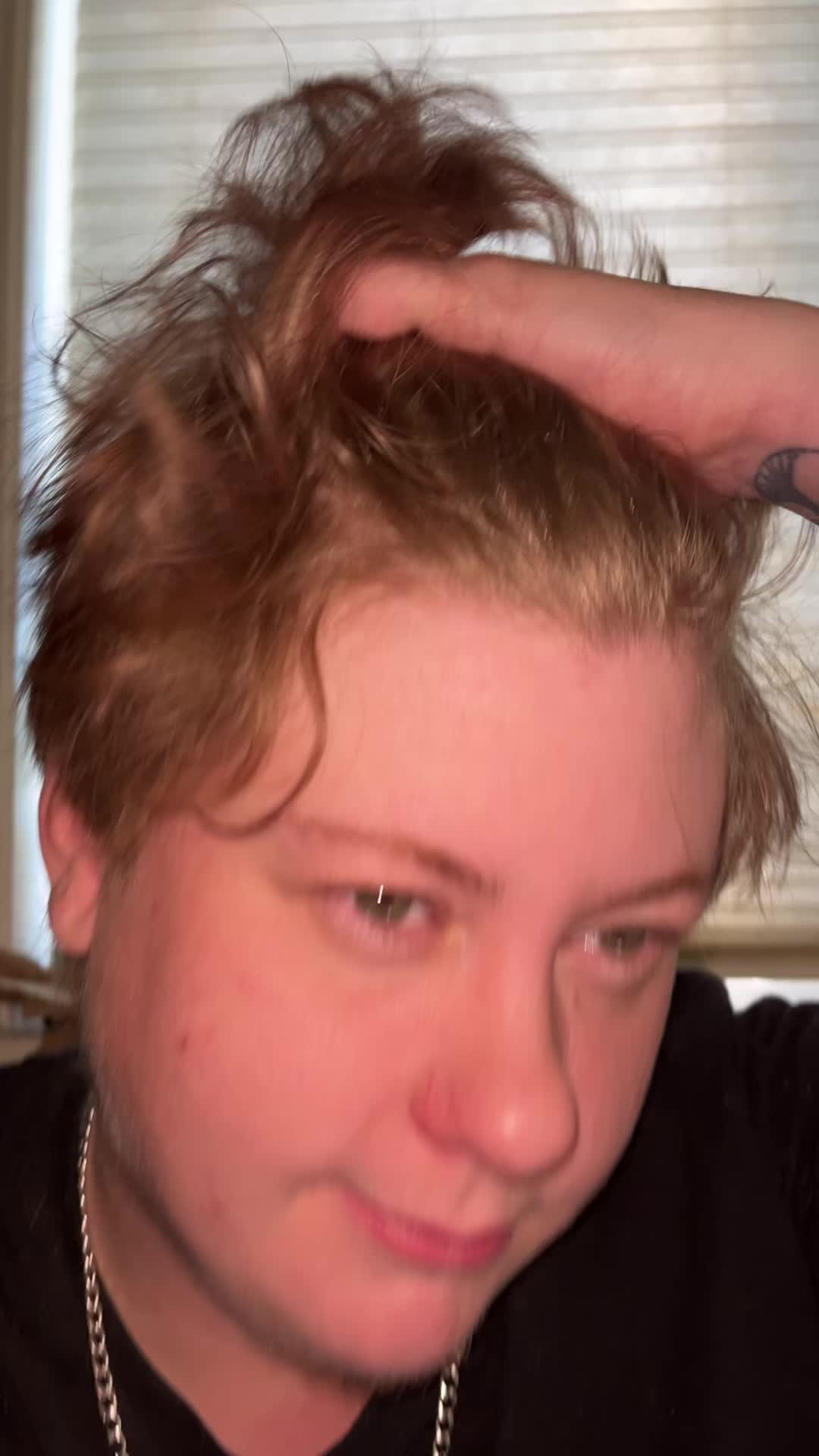 @finnsrecoveryjourney