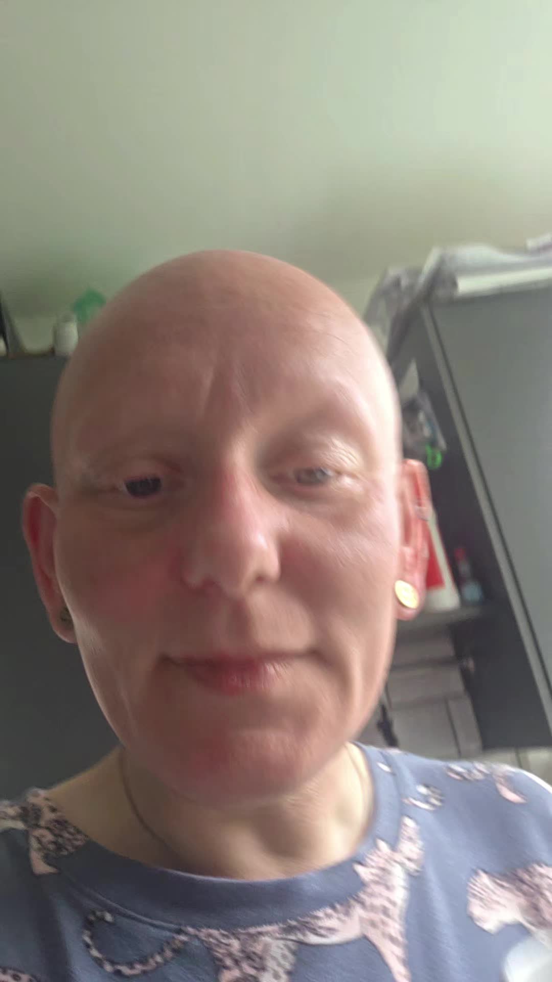 @baldies_adventures