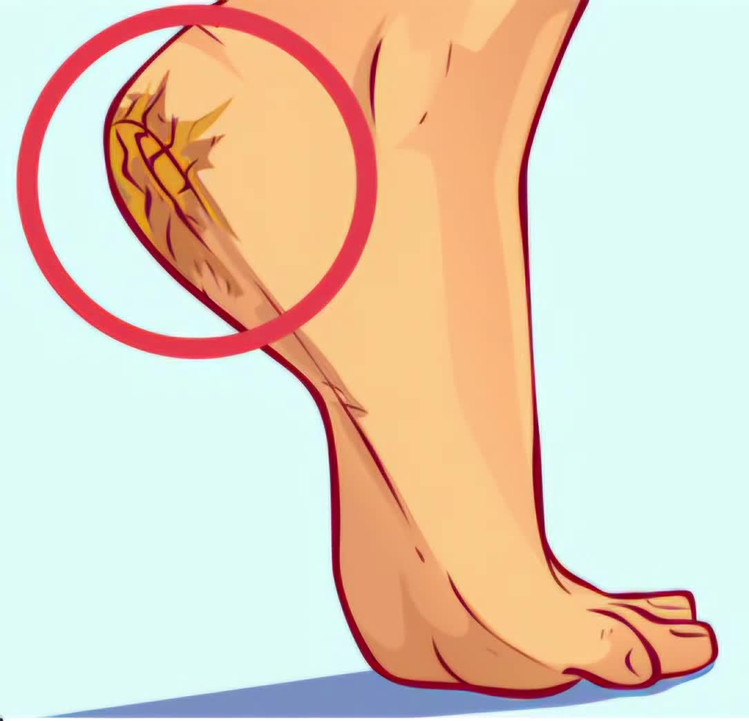 @Home Podiatry