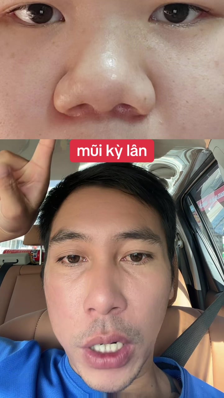@Tuệ Nh&atilde;n ✅