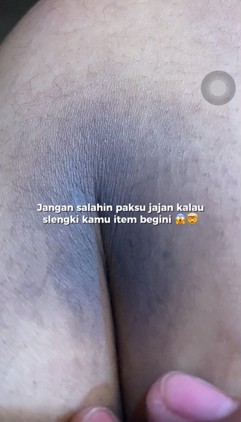 @Celluvieid