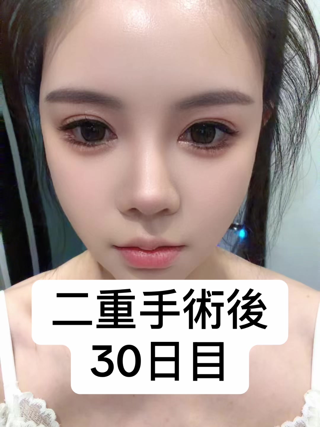 @Avant美容外科