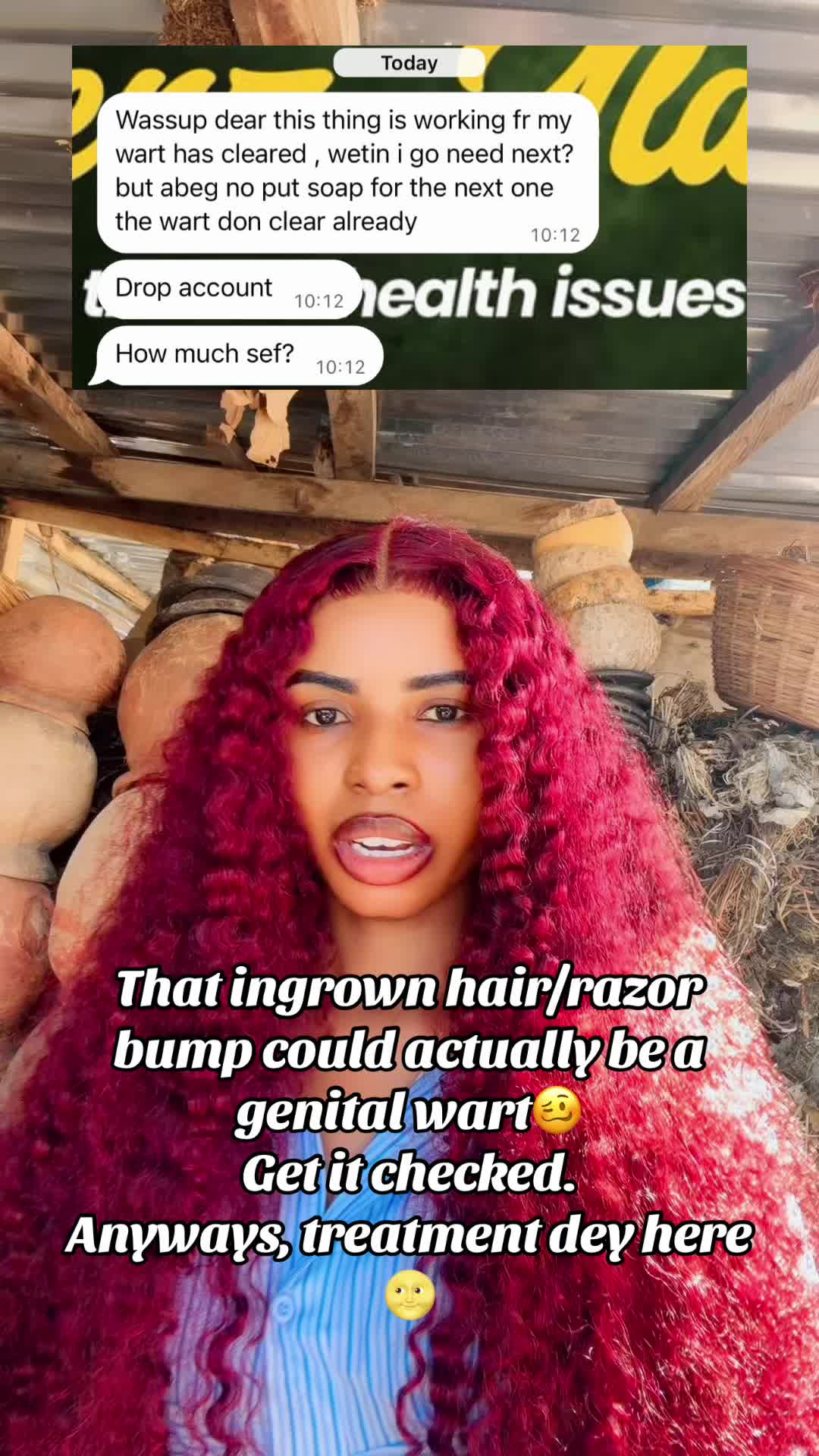 @GeNz_alagbo🐍🍯