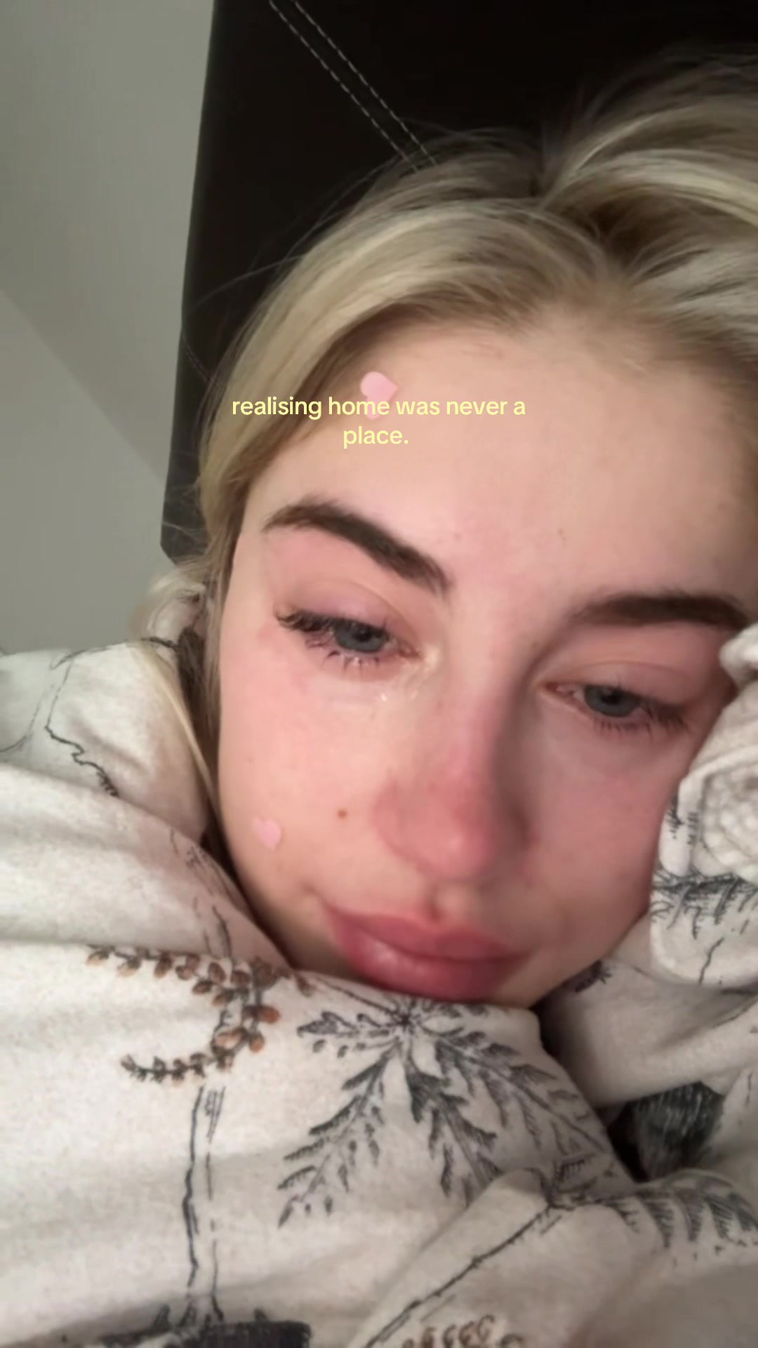 @em