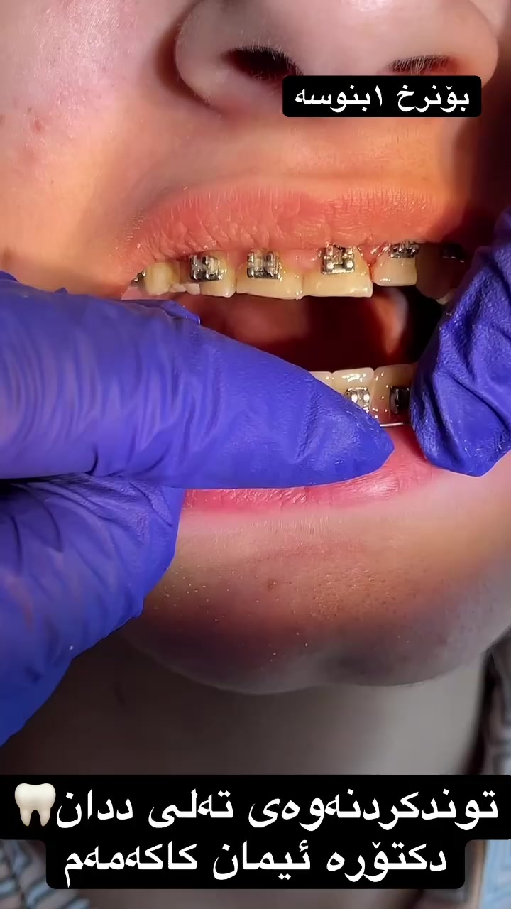@🦷 دکتۆرە ئیمان کاکەمەم