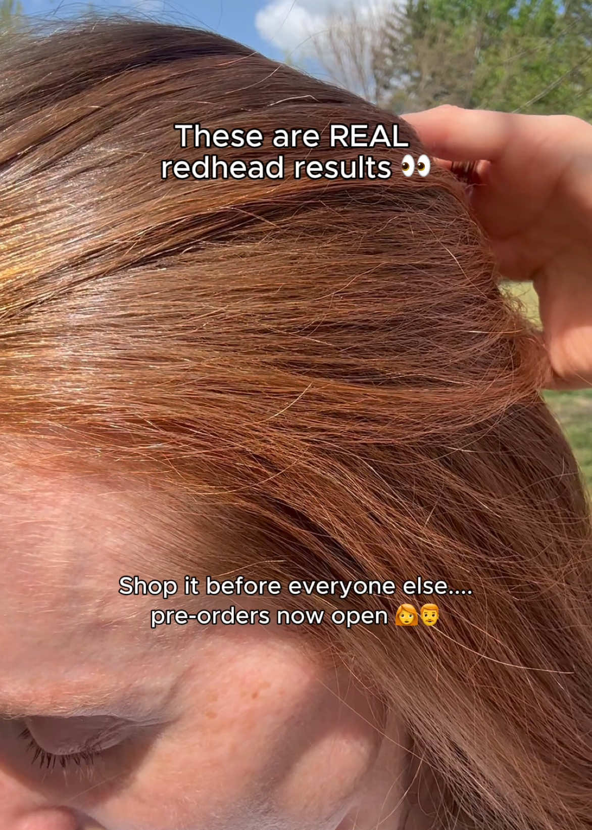 @How to be a Redhead