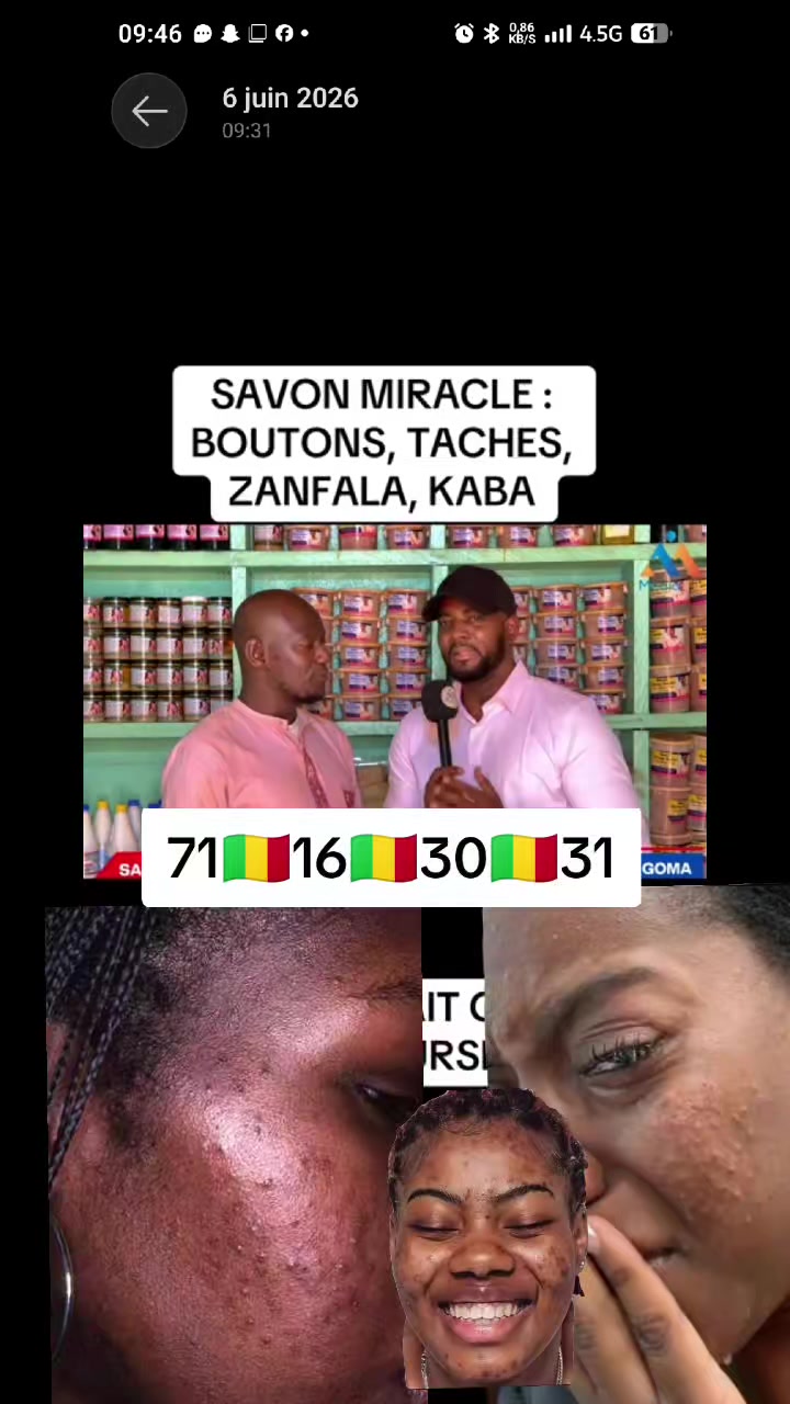 @MALI22 TV