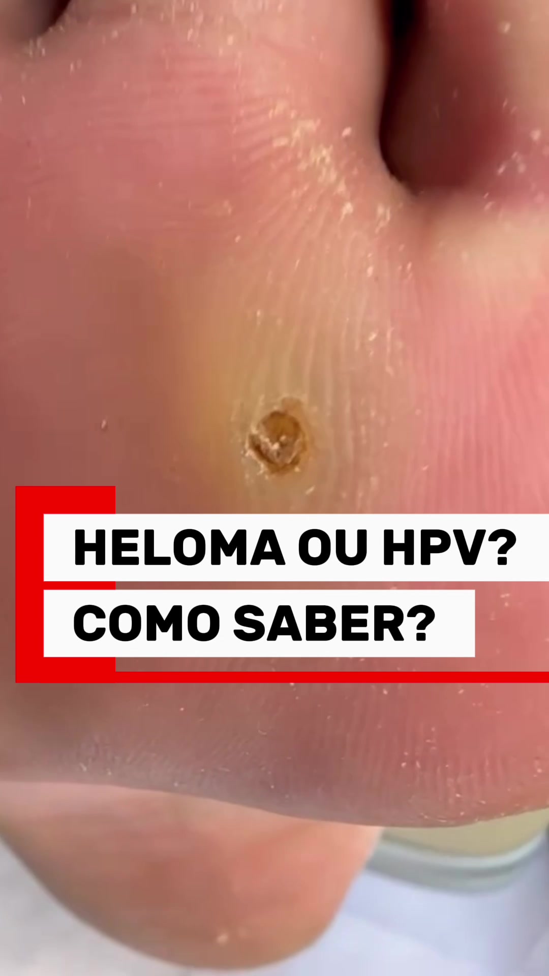 @Podocurebr