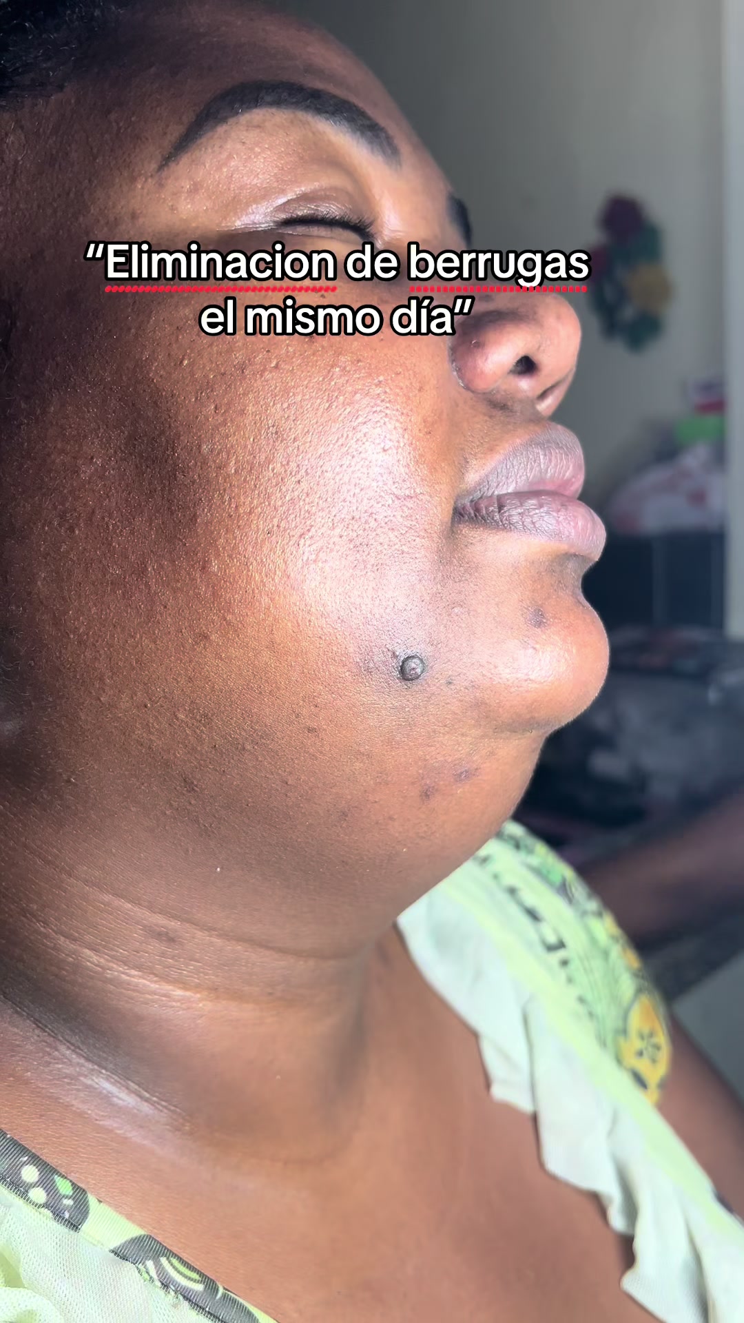 @yaconilip