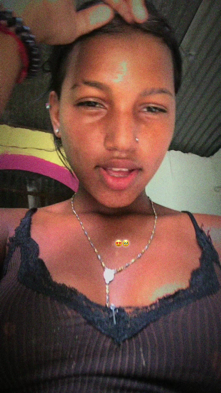 @yoxima15