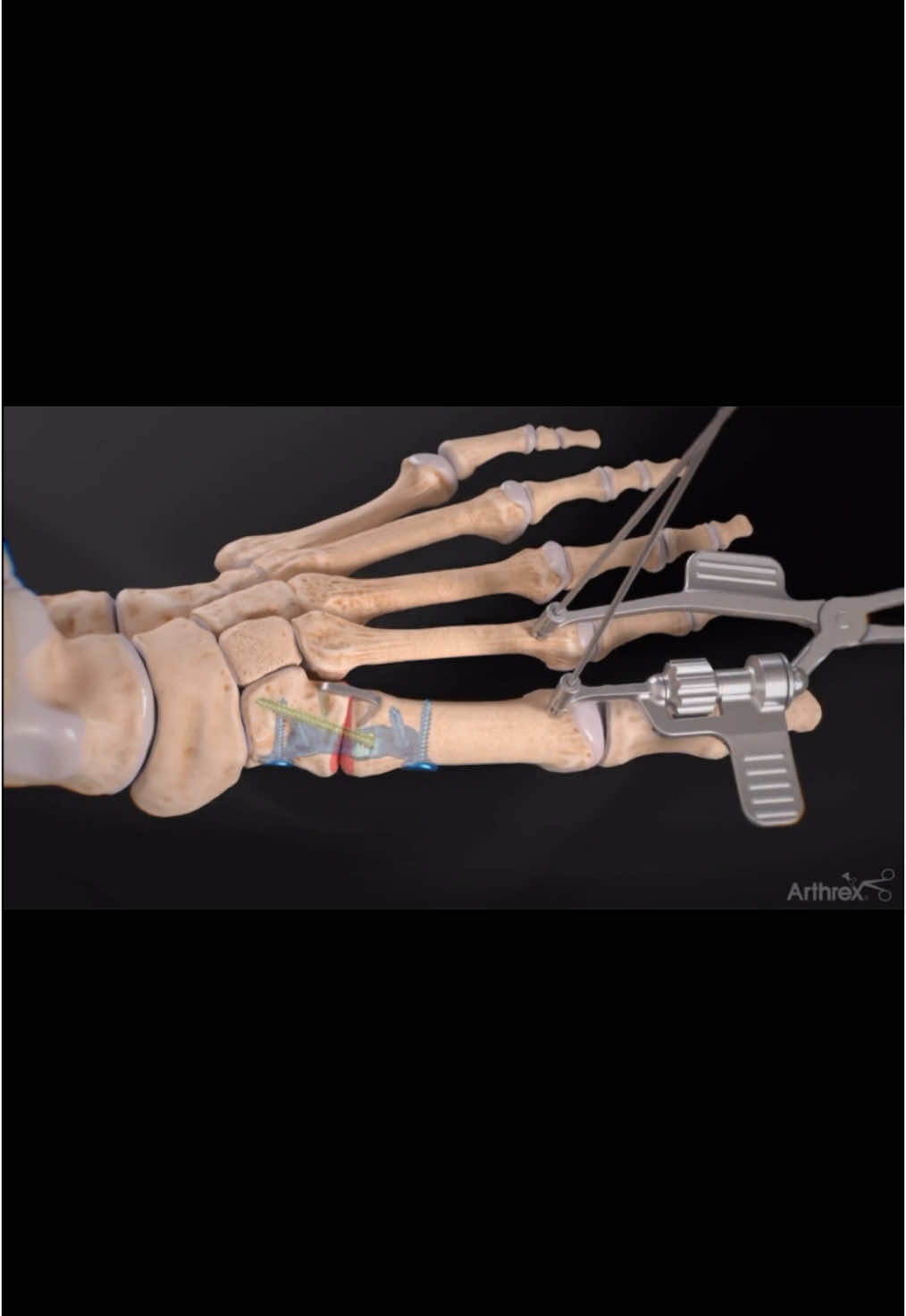 @Anatomias