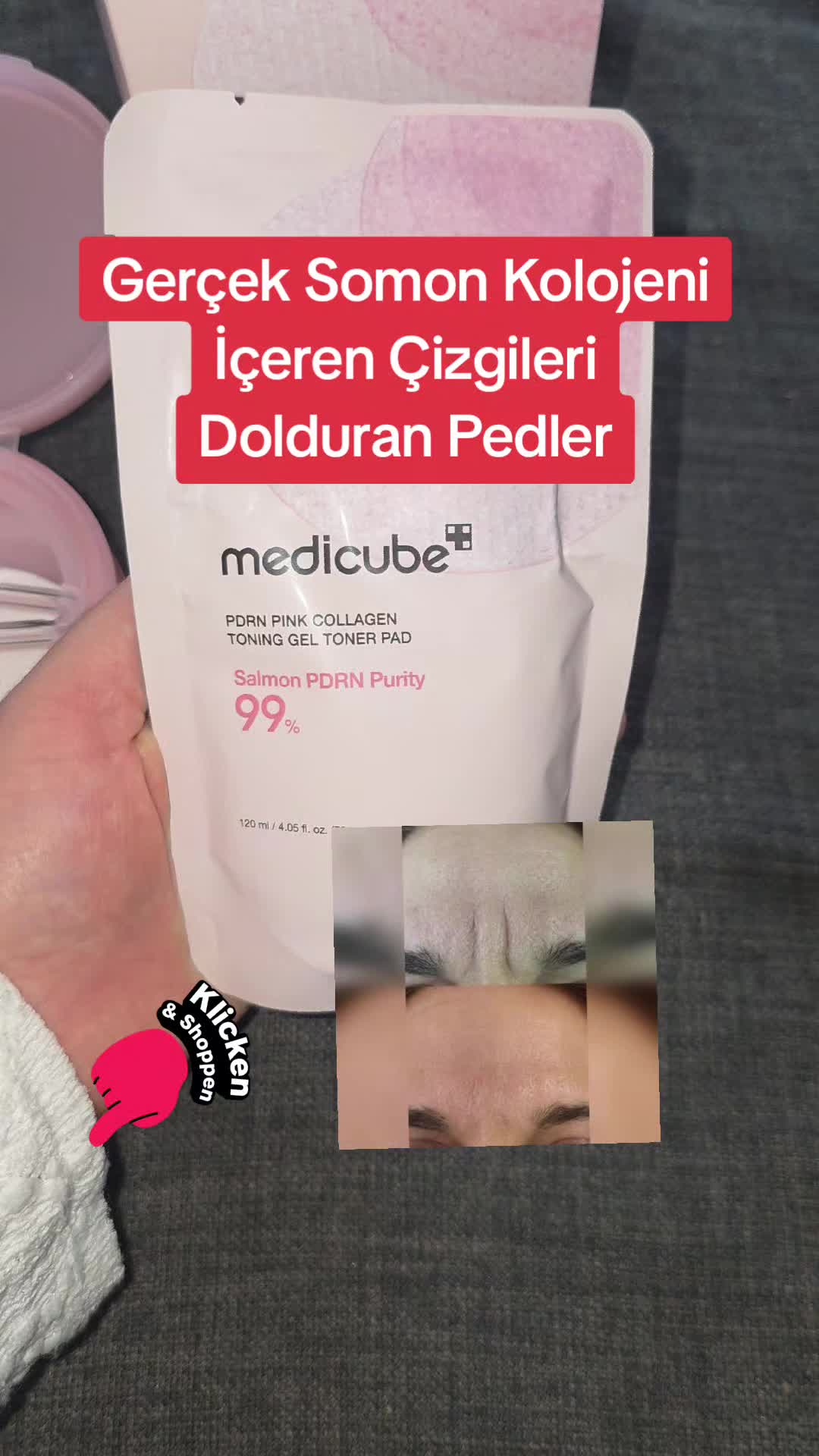 @Gurbetana27