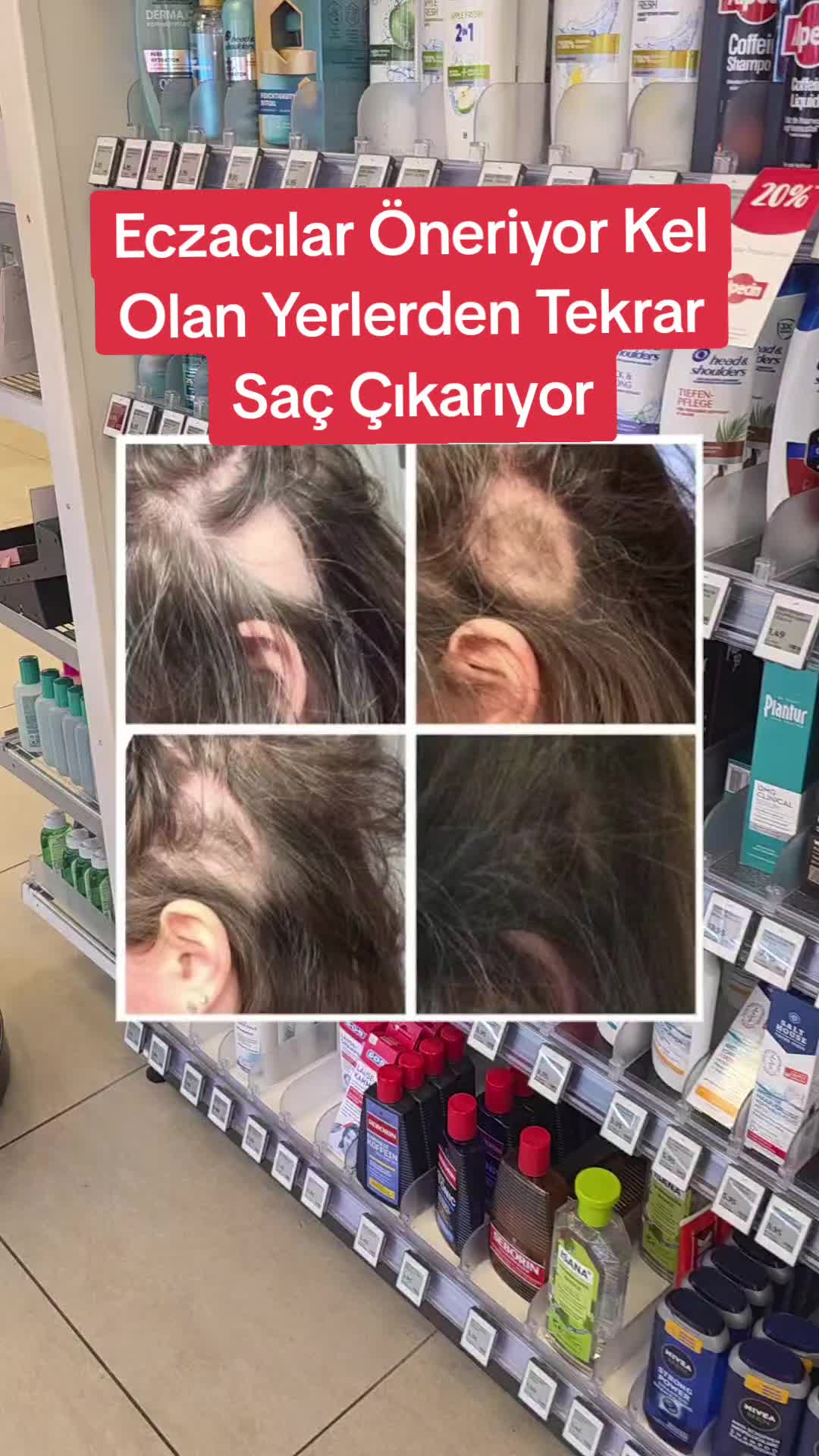 @Gurbetana27
