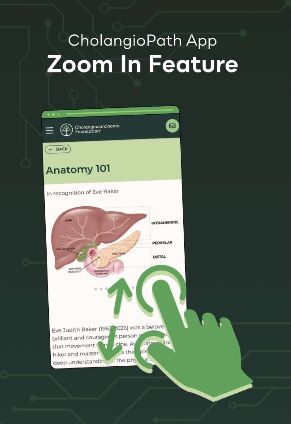 @Cholangiocarcinoma