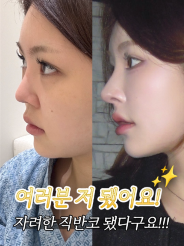 @리셋성형외과