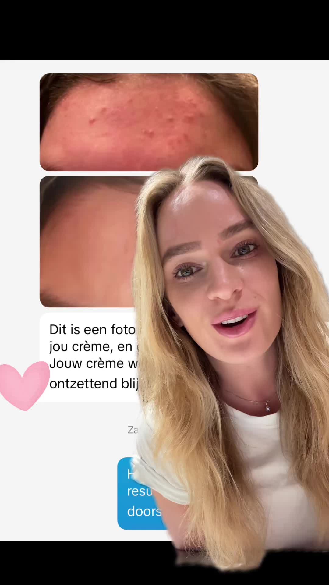@Rebecca | Huidtherapeut✨