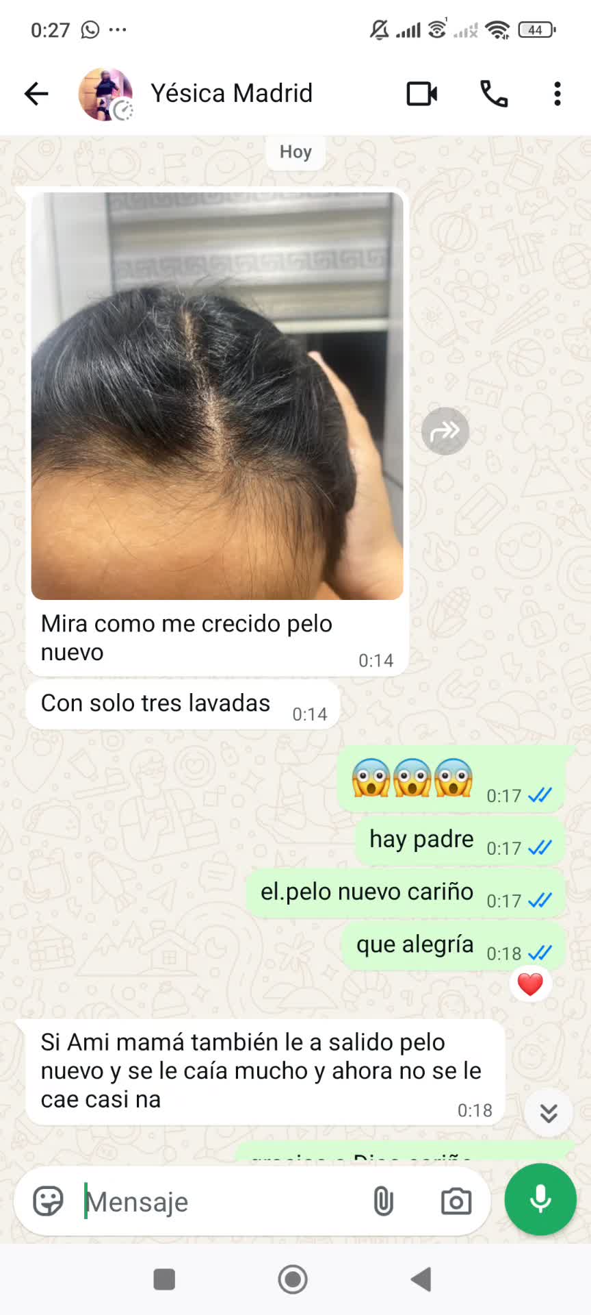 @Ester Salazar