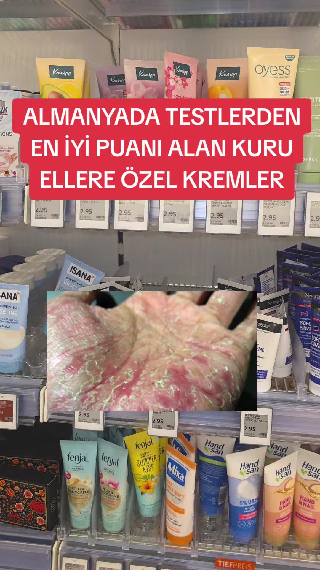 @Gurbetana27