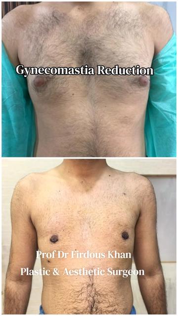 @Dr Firdous Khan PlasticSurgeon