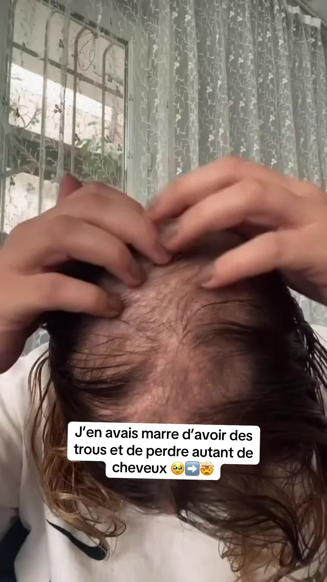 @Lux’Hair Growth FR