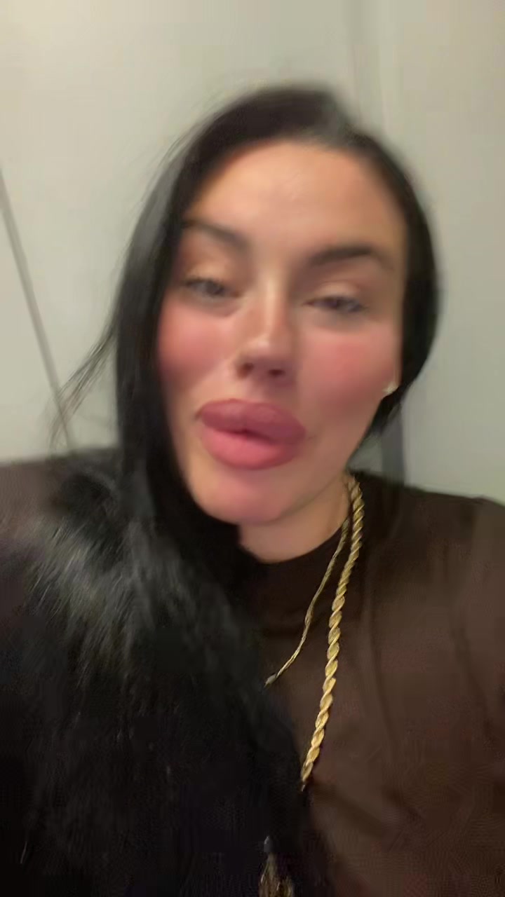 @Alessia albino