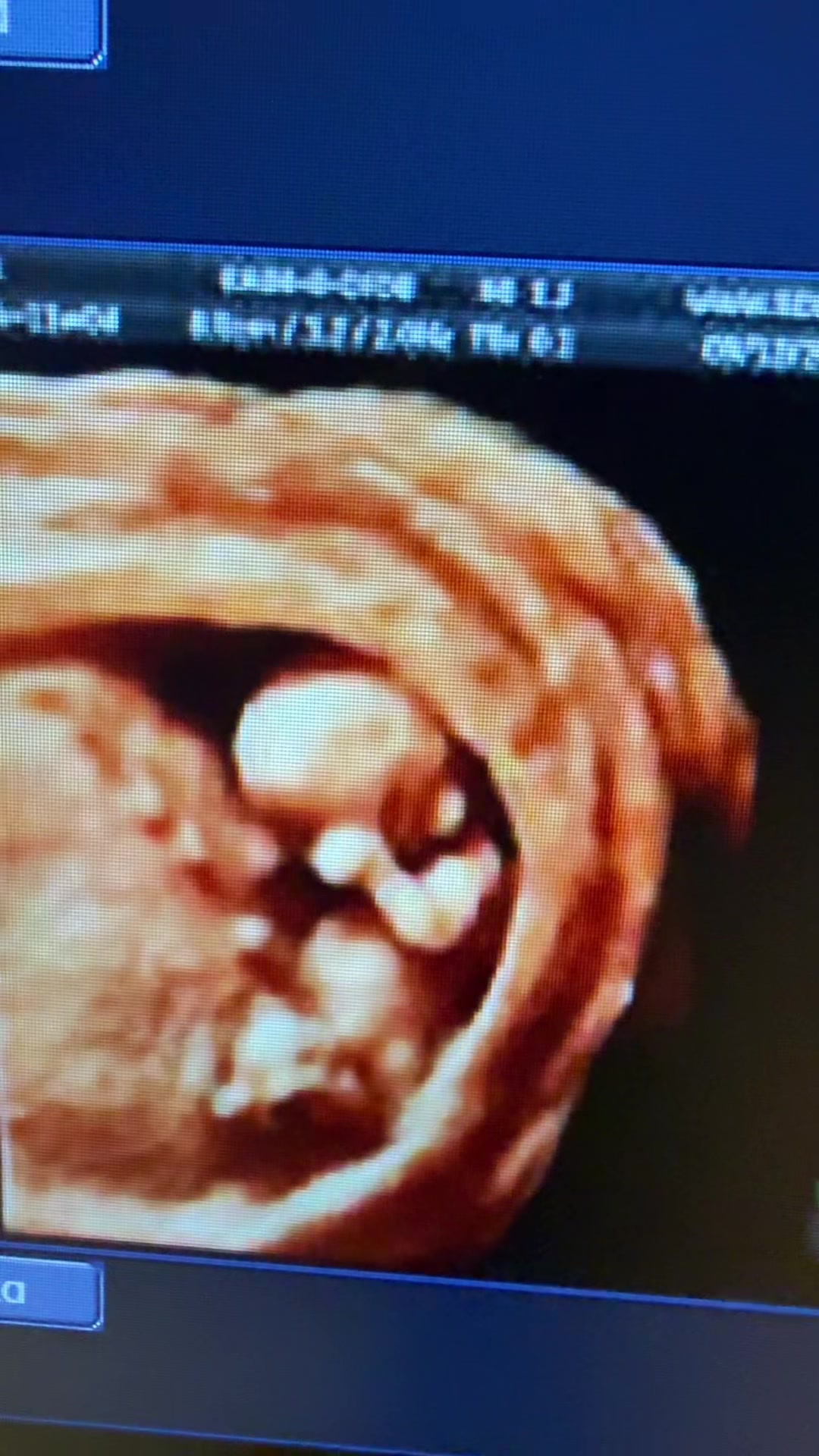 @PregnantSee Inc.