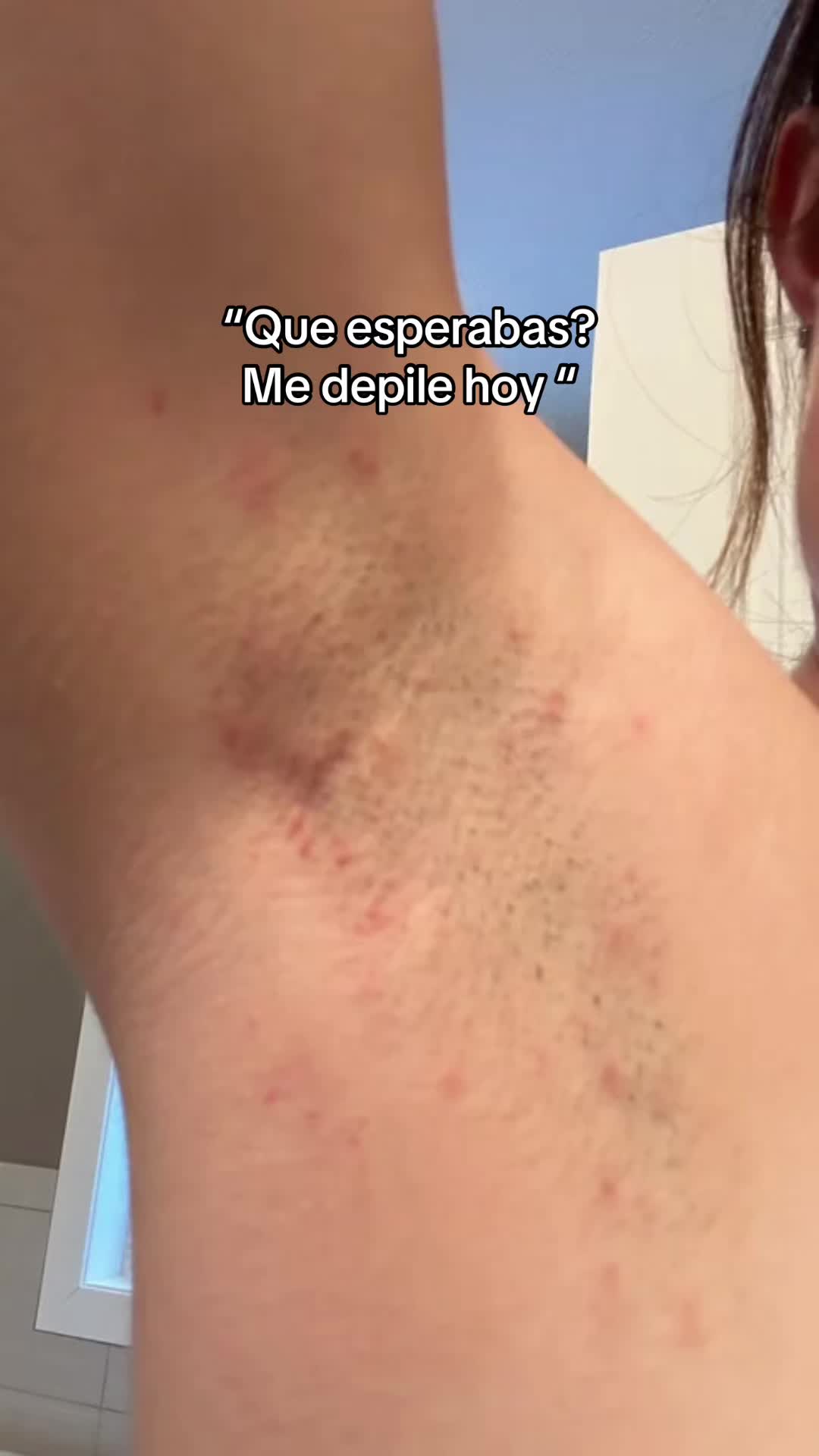 @Andy