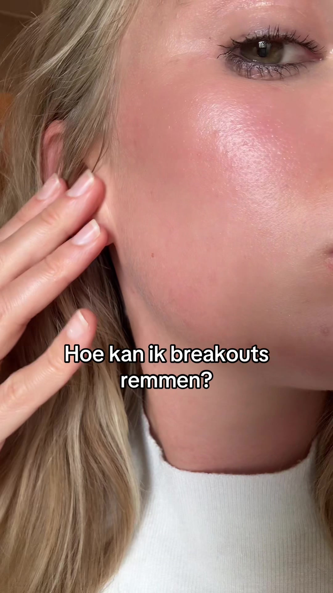 @Rebecca | Huidtherapeut✨