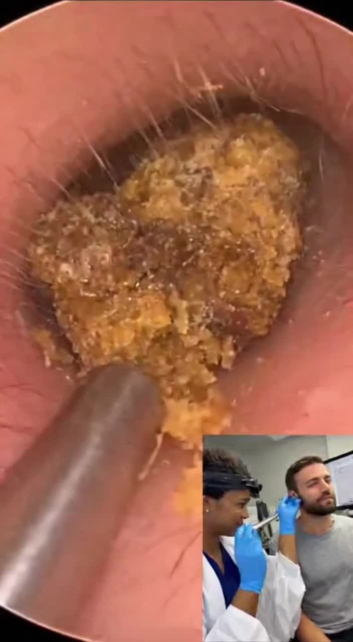 @Ear Cleaning