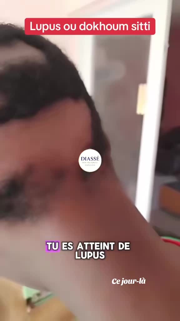 @DIASS&Eacute; HAIR 📞 765521010